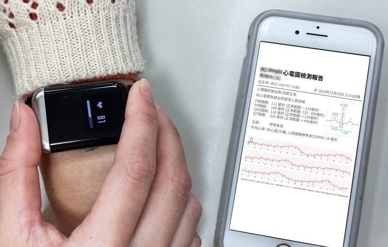 穿戴心電圖記錄器手錶每半小時主動偵測是否有心跳不規律的風險指標，Android 及iOS 雙平台用戶皆可下載相對應的APP。官方提供