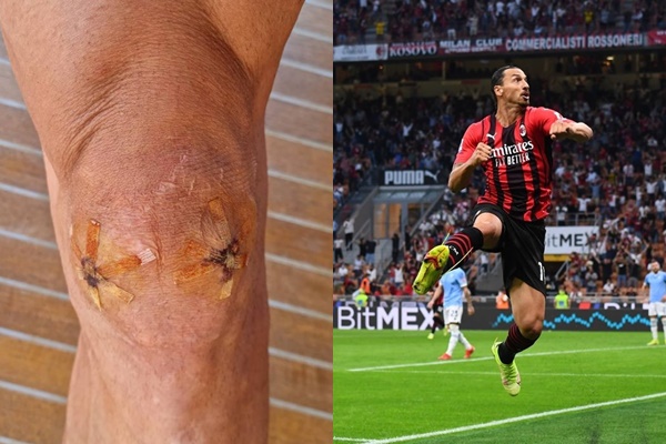 39歲老將老將伊布拉西莫維奇經過膝蓋手術4個月復出首戰就進球。合成照片