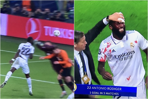 鐵衛呂迪格(Antonio Rüdiger)不顧危險進球。合成照片