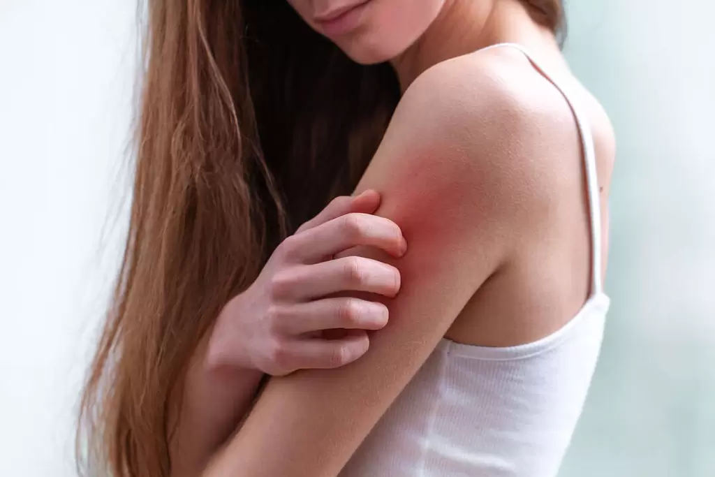貼酸痛貼布會過敏? 藥布疹、紅腫癢是如何造成的？